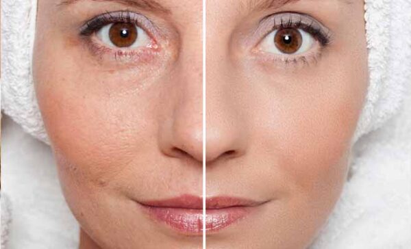 Serum Kiehl's Lifting Pore-Tightening Concentrate 50ml - Image 5