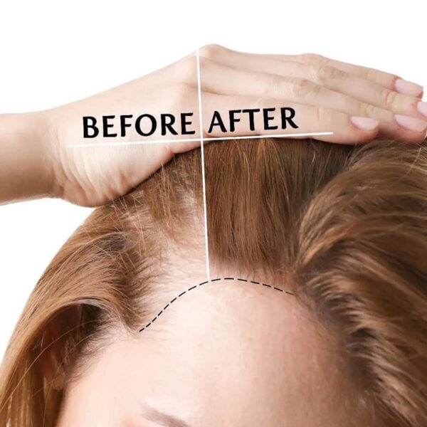 Bộ Sản Phẩm Kích Mọc Tóc Mielle Rosemary Mint Strengthening - Image 4