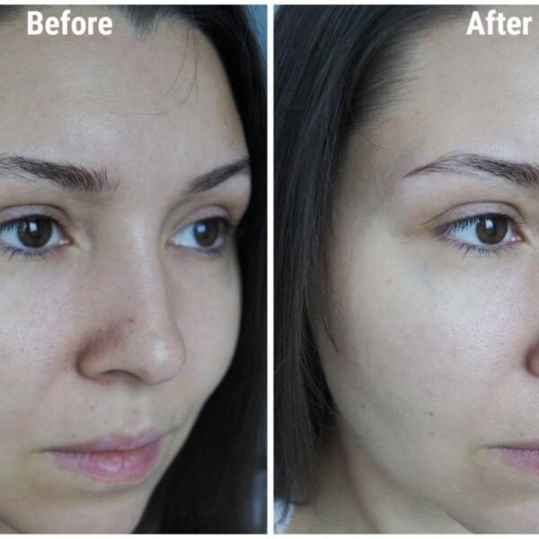 Kem Dưỡng The Ordinary Vitamin C Suspension 23% + HA Spheres 2% 30ml - Image 3