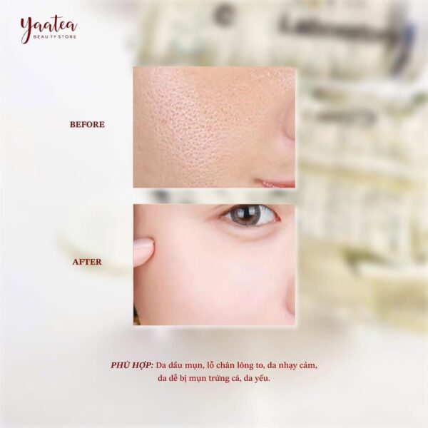 Serum Keo Ong CNP Propolis Rescue Ampoule 50ml - Image 4