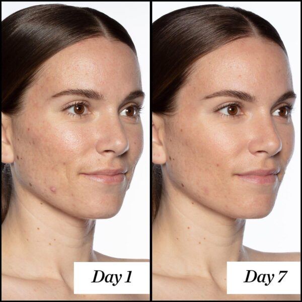 Serum Sunday Riley Good Genus 30ml - Image 5