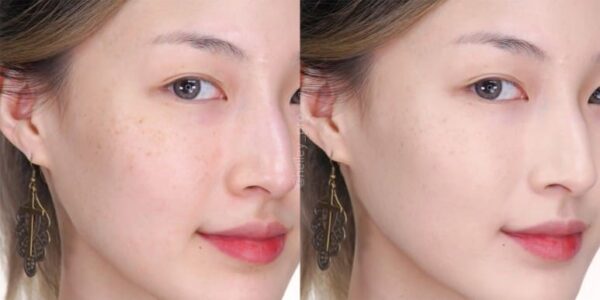 Cushion Clio Fixer - Image 4