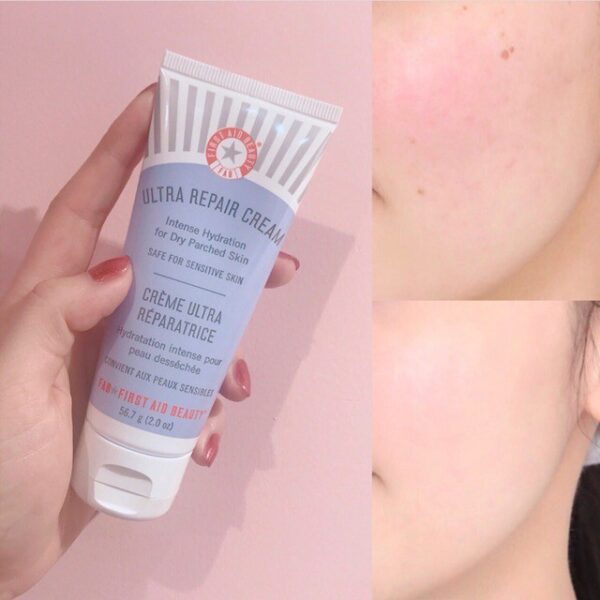 Kem Dưỡng First Aid Beauty Ultra Repair Cream 56.7g - Image 3