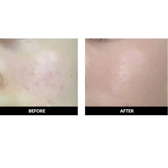 Che Khuyết Điểm Hũ LUNA Conceal Pot - Image 3