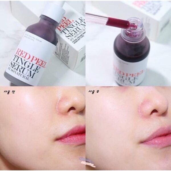 Serum So’Natural Red Peel Tingle 11ml - Image 5