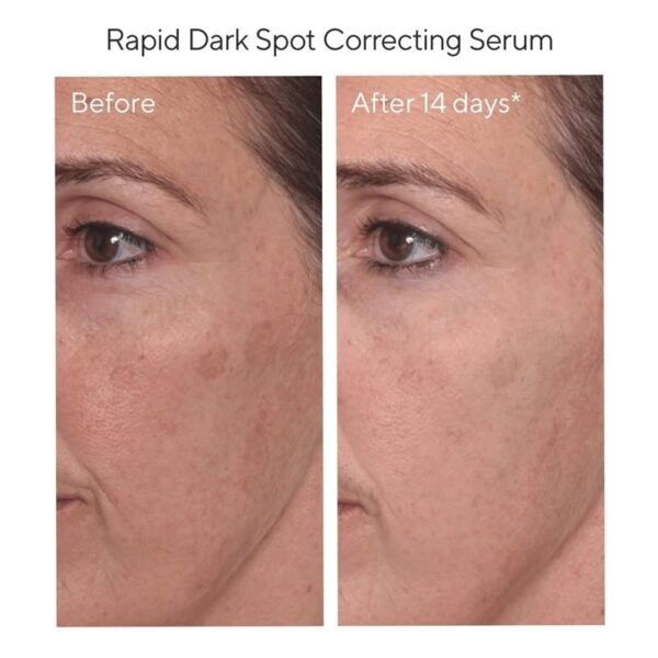 Serum Murad Rapid Dark Spot Correcting 30ml - Image 4