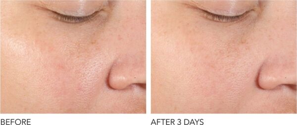 Serum Dr. Dennis Gross Alpha Beta 4ml - Image 4