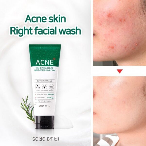 SRM Some By Mi Acne AHA-BHA-PHA 30 Day - Image 4