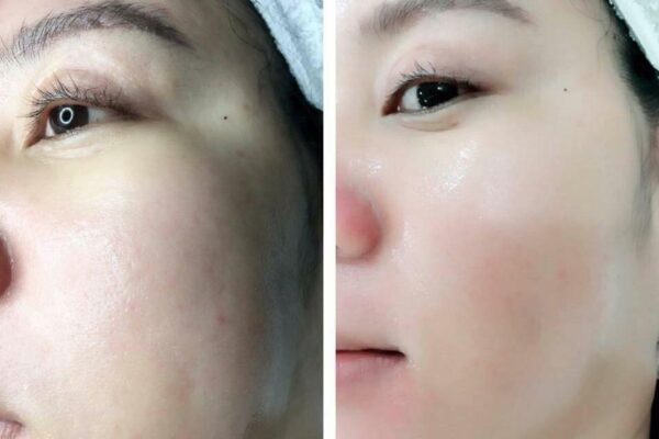 Serum Estee Lauder ANR 10 Viên - Image 4