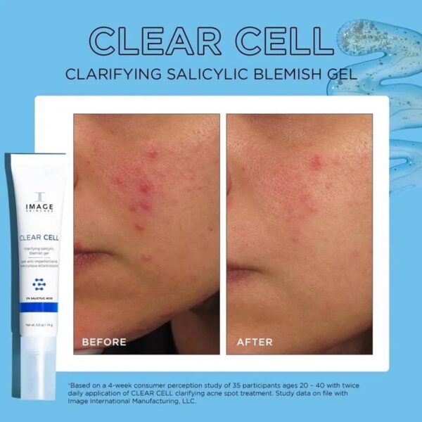 Gel Chấm Mụn Image Clear Cell Clarifying Salicylic Blemish 14g - Image 3