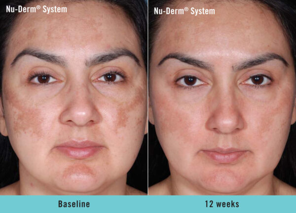 [CHIẾT KHẤU 20%] Obagi số 5 (57g) CT - Image 3