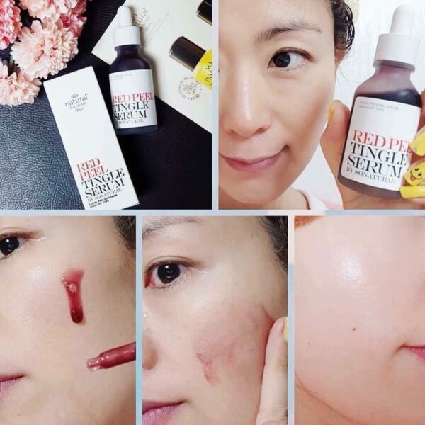 Serum So Natural Red Peel Tingle - Image 5