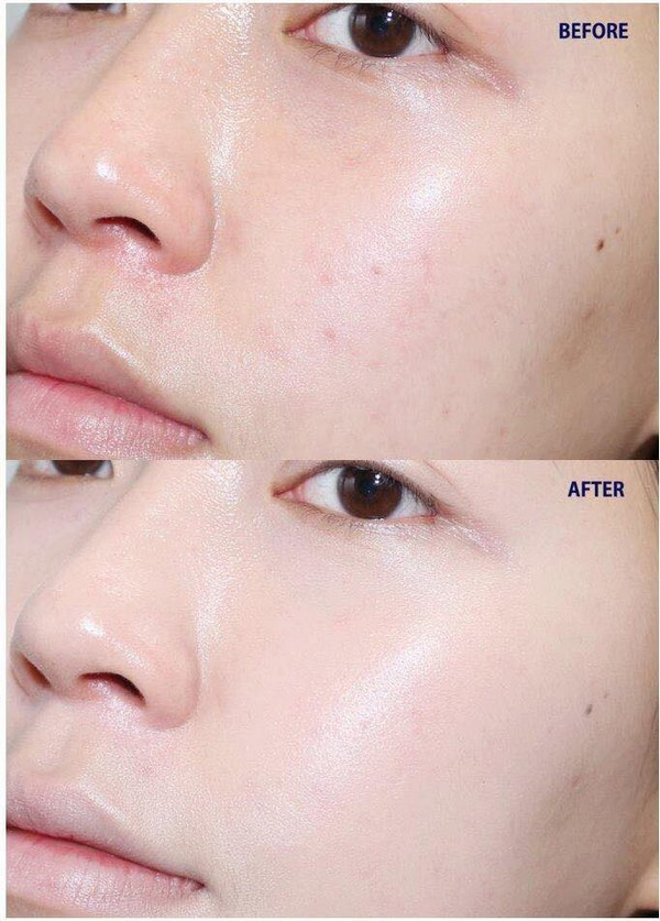 Cushion Lime V Collagen - Image 10