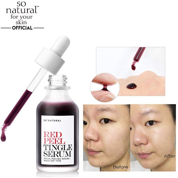 Serum So Natural Red Peel Tingle - Image 2