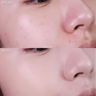 Cushion Clio Fixer - Image 5