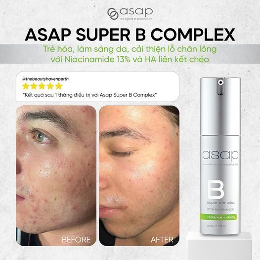 Serum Asap B Niacinamide Super Complex 30ml - Image 5