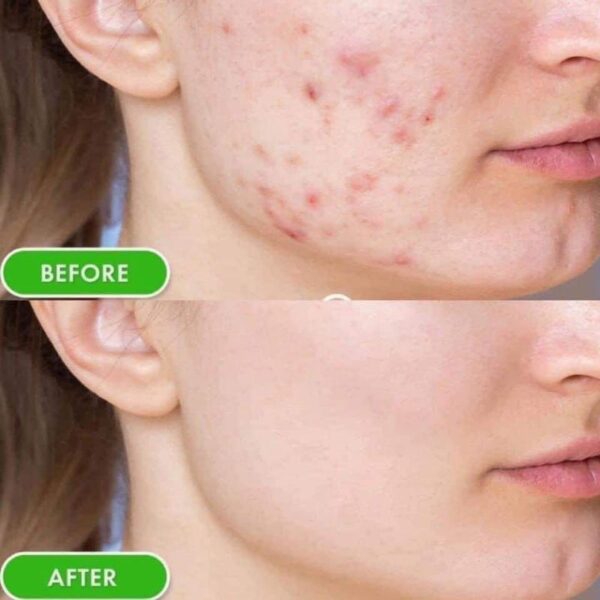 Kem Dưỡng SVR Sebiaclear Active Gel 40ml XT - Image 5